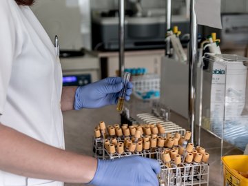 Das Foto zur Pressemitteilung der Linken zur Laborschließung in Gelsenkirchen zeigt eine Laborantin mit verschiedenen Blutproben