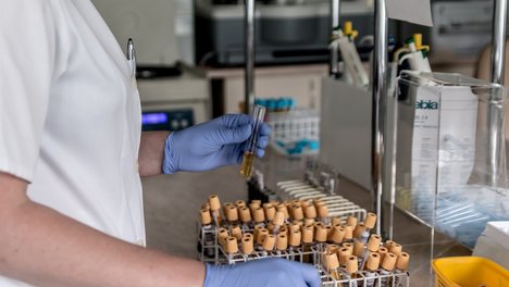 Das Foto zur Pressemitteilung der Linken zur Laborschließung in Gelsenkirchen zeigt eine Laborantin mit verschiedenen Blutproben